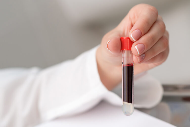 4 Exames Essenciais para Rastrear Infecções Sexualmente Transmissíveis (ISTs)