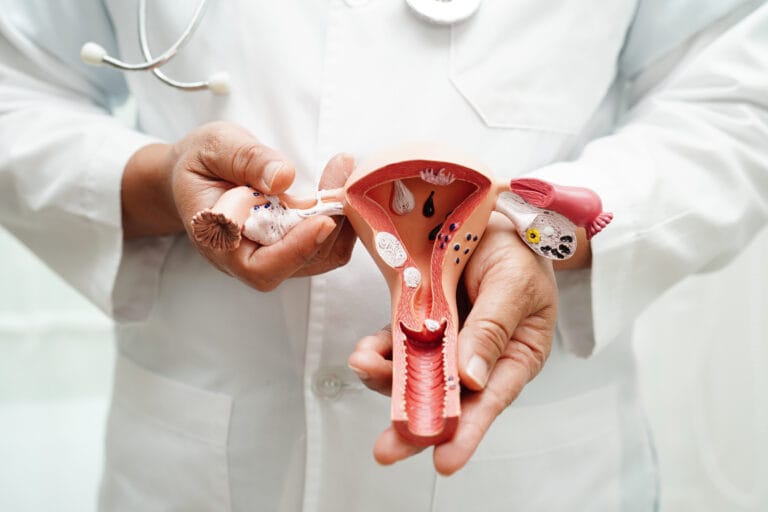 Adenomiose: Sintomas, Diagnóstico e Opções de Tratamento