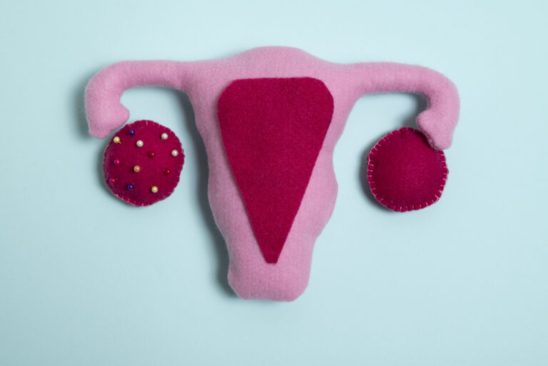 Endometriose profunda: o que você precisa saber sobre diagnóstico e tratamento