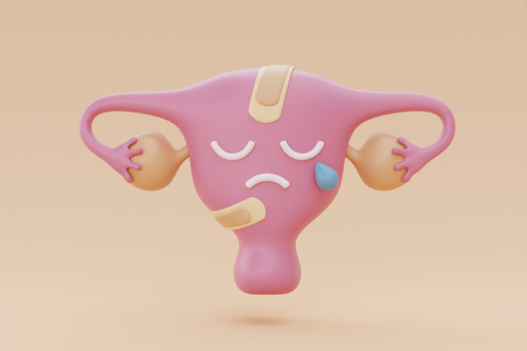 Endometriose: sintomas, diagnóstico e opções de tratamento