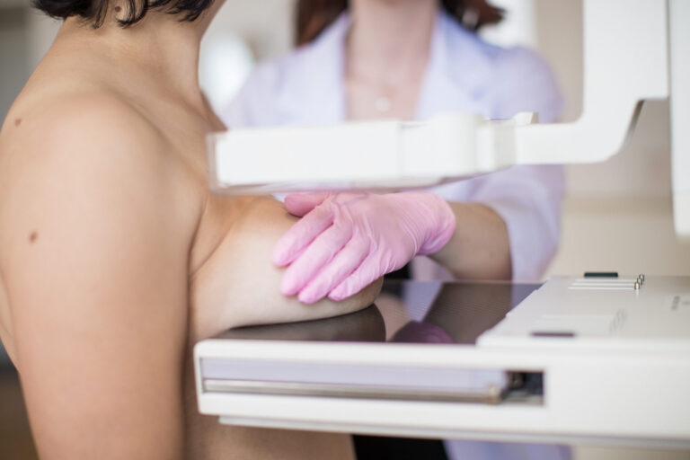 Novas diretrizes para a mamografia: rastreamento a partir dos 40 anos